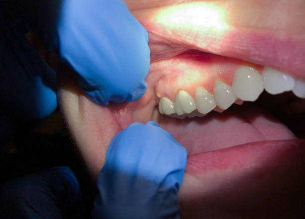 Best Emergency Cosmetic Dentistry in Rogers, TX
